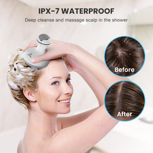 Comfier Head Massager Comfier Electric Scalp Massager Hair Growth, Cordless Head Massager Scalp Stress Relax, Waterproof Handheld Hair Scratcher with 84 Silicone Nodes CF-4902N